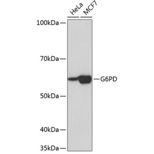 G6PD Rabbit mAb