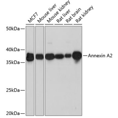 Annexin A2 Rabbit mAb