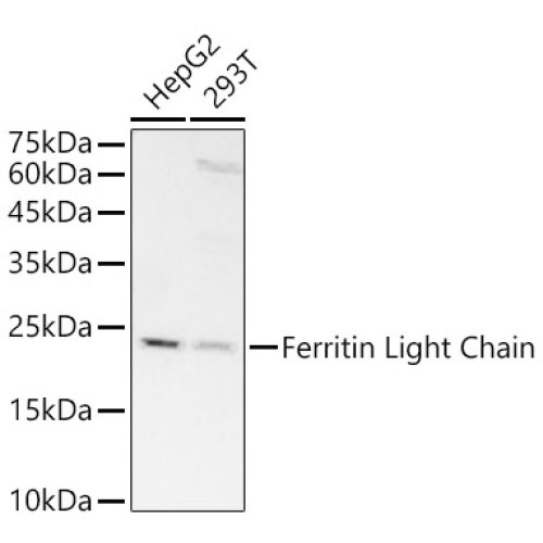[KD Validated] Ferritin Light Chain Rabbit mAb