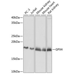 [KD Validated] GPX4 Rabbit mAb