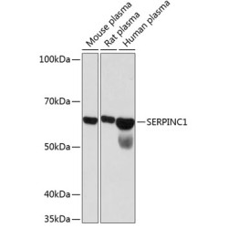 SERPINC1 Rabbit mAb