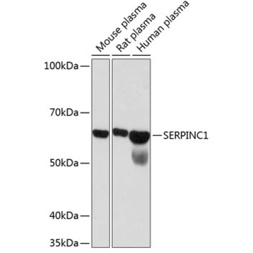 SERPINC1 Rabbit mAb