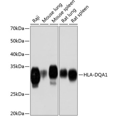 HLA-DQA1 Rabbit mAb