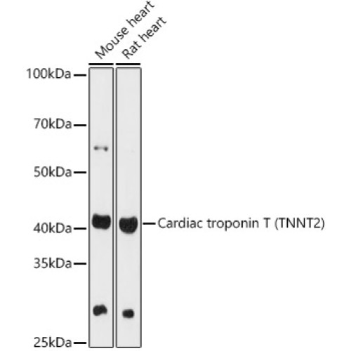 Cardiac troponin T (TNNT2) Rabbit pAb