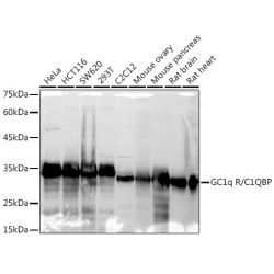 GC1q R/C1QBP Rabbit mAb