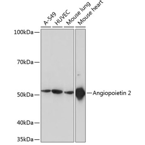 ANGPT2 Rabbit mAb