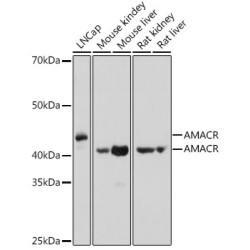 AMACR Rabbit pAb