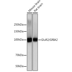 GluR2/GRIA2 Rabbit mAb