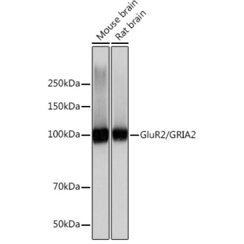 GluR2/GRIA2 Rabbit mAb