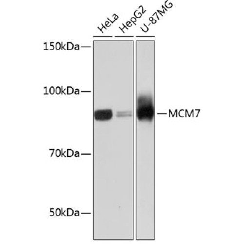 MCM7 Rabbit mAb