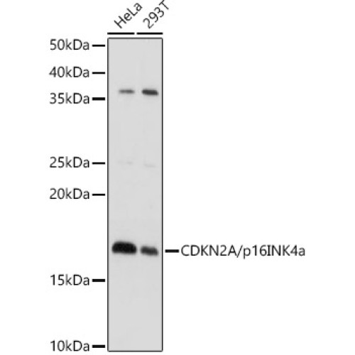 CDKN2A/p16INK4a Rabbit pAb