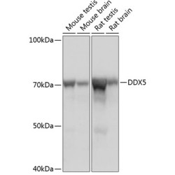 DDX5 Rabbit mAb