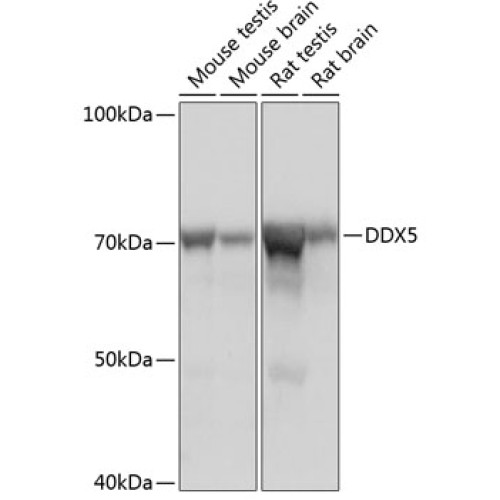 DDX5 Rabbit mAb