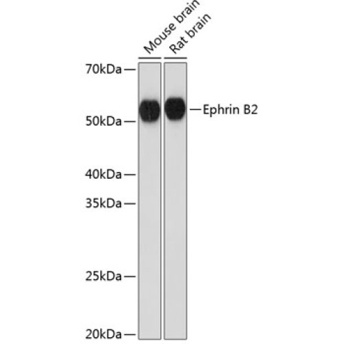 Ephrin B2 Rabbit mAb