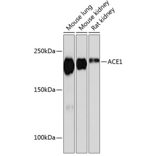ACE1 Rabbit mAb