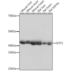 GOT1 Rabbit mAb