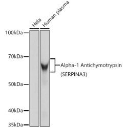 Alpha-1 Antichymotrypsin (SERPINA3) Rabbit mAb