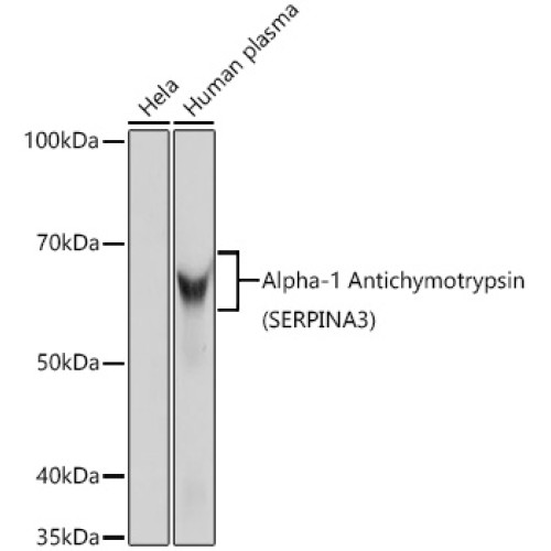 Alpha-1 Antichymotrypsin (SERPINA3) Rabbit mAb