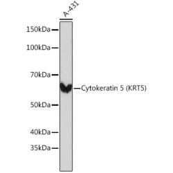 Cytokeratin 5 Rabbit mAb
