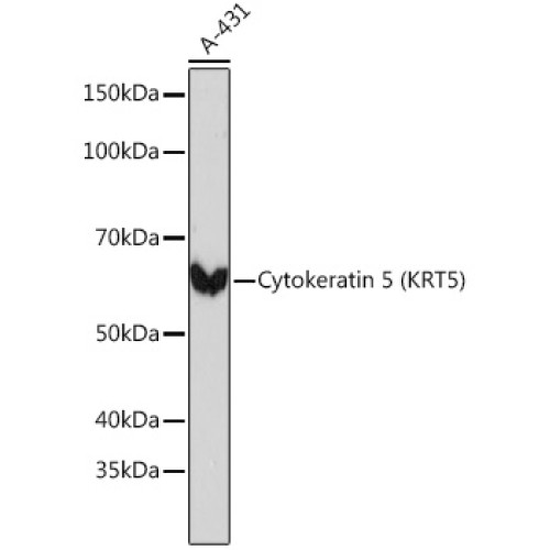 Cytokeratin 5 Rabbit mAb