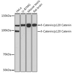 δ-Catenin/p120 Catenin Rabbit mAb