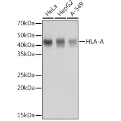 HLA-A Rabbit mAb