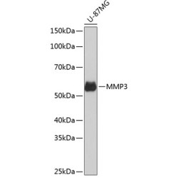 MMP3 Rabbit mAb