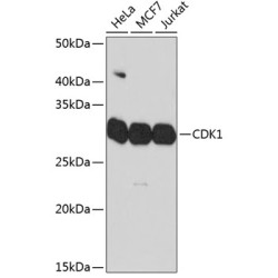 CDK1 Rabbit mAb