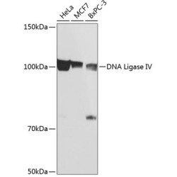 DNA Ligase IV Rabbit mAb