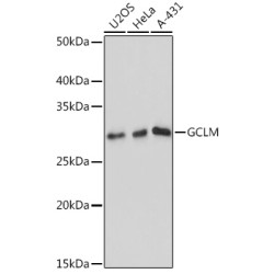 GCLM Rabbit mAb