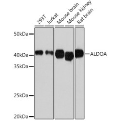ALDOA Rabbit mAb