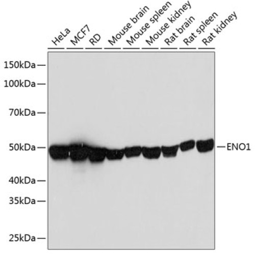 ENO1 Rabbit mAb