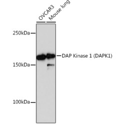 DAP Kinase 1 (DAPK1) Rabbit mAb
