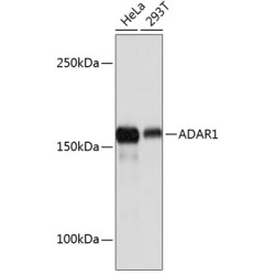 ADAR1 Rabbit mAb