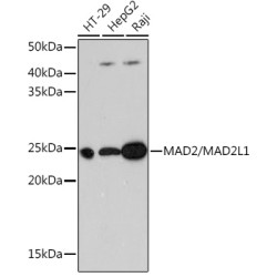 MAD2/MAD2L1 Rabbit mAb