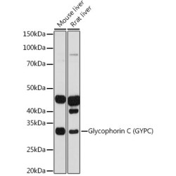 Glycophorin C (GYPC) Rabbit mAb