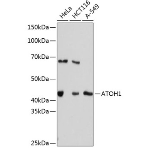 ATOH1 Rabbit mAb