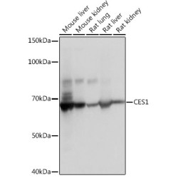CES1 Rabbit mAb