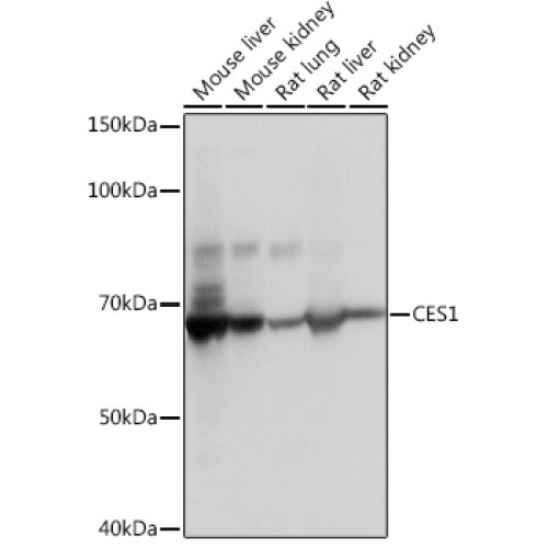 CES1 Rabbit mAb