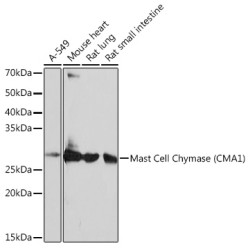 Mast Cell Chymase (CMA1) Rabbit mAb