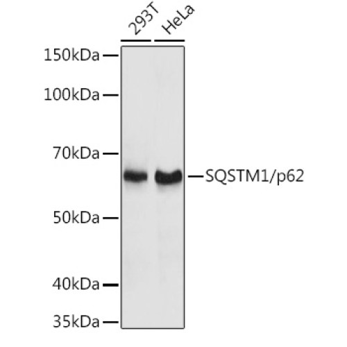 SQSTM1/p62 Rabbit pAb