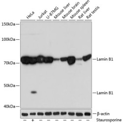 Lamin B1 Rabbit mAb