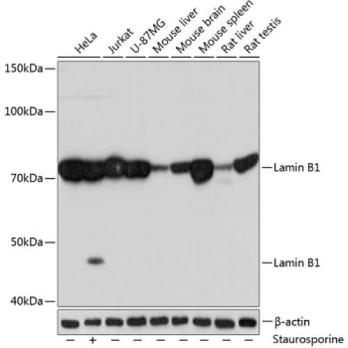Lamin B1 Rabbit mAb
