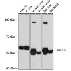 ALDH2 Rabbit mAb