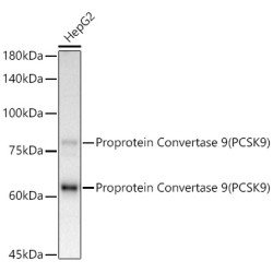 [KD Validated] Proprotein Convertase 9(PCSK9) Rabbit mAb