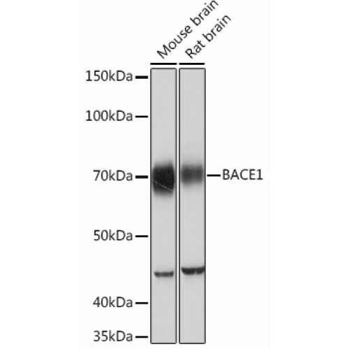 BACE1 Rabbit mAb