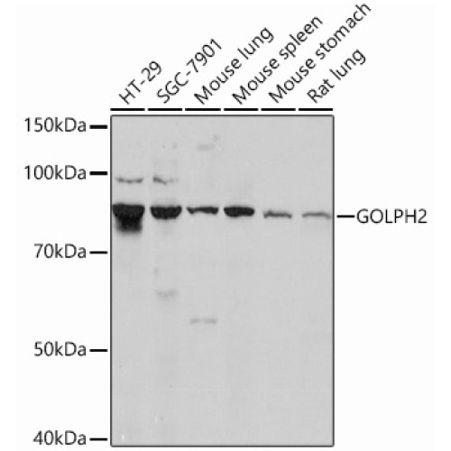 GOLPH2 Rabbit mAb