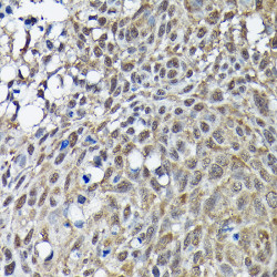 BRCA1 Rabbit pAb