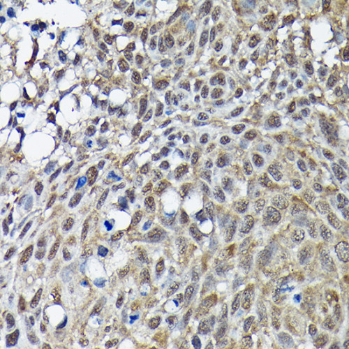 BRCA1 Rabbit pAb