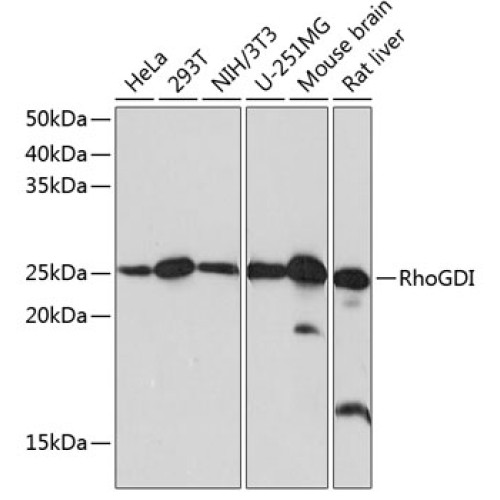 [KO Validated] RhoGDI Rabbit mAb